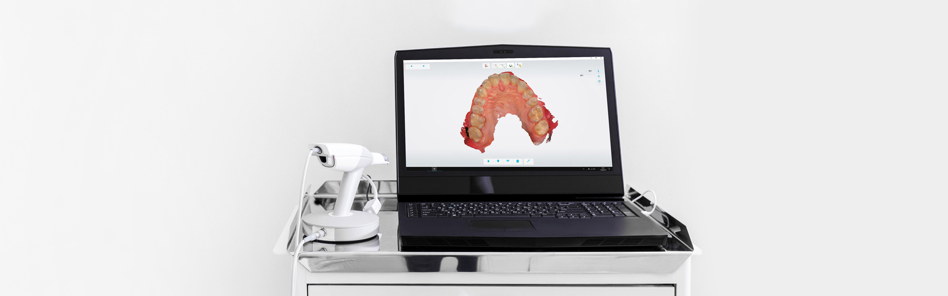 Intraoral Scanner